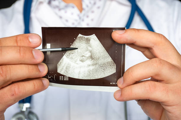 istock Liver hematoma  on ultrasound image concept photo. Doctor indicating by pointer on printed picture of ultrasound pathology of liver or hepatic hematoma. For diagnosis, radiology, hepatology, surgery 1196964328