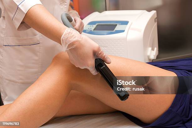 Laser Hair Removal Stock Photo - Download Image Now - Medical Laser, Adult, Adults Only