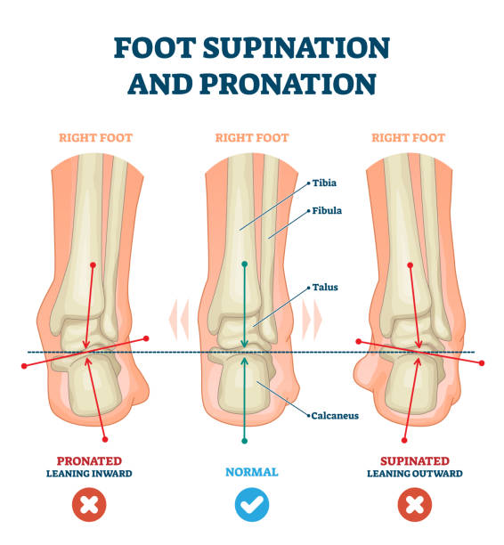 Foot supination and pronation vector illustration. Labeled medical scheme. vector art illustration