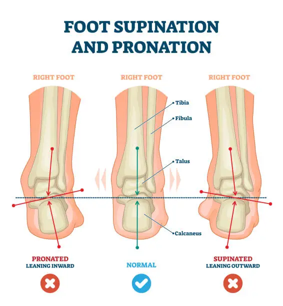 Vector illustration of Foot supination and pronation vector illustration. Labeled medical scheme.