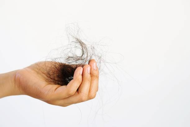 Hair loss in hand woman,white background stock photo