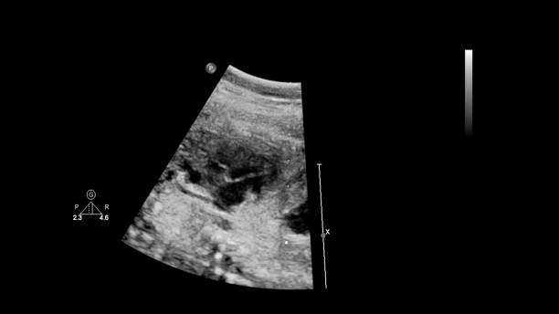 istock Ultrasound screen with fetal echocardiography. 1197113227