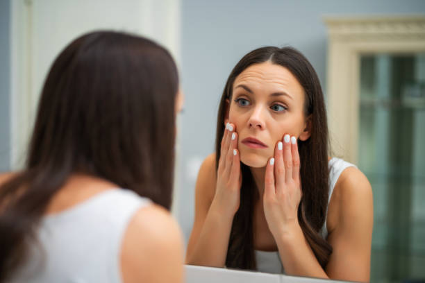 Woman looking at her eye bags