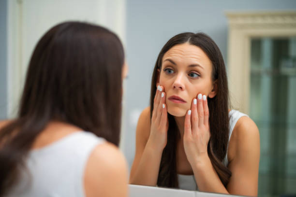 Woman looking at her eye bags Tired woman looking at her eye bags in the bathroom. swollen stock pictures, royalty-free photos & images