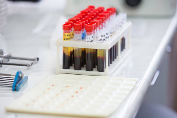 istock Blood test.Blood in test tubes 1197137303