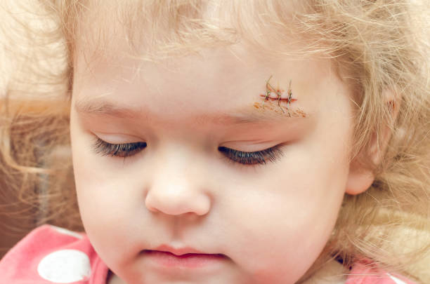 Как выглядит шрам на лице Как выглядит шрам на лице