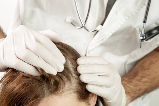 6,447 Hair Loss Doctor Stock Photos, Pictures & Royalty-Free Images -  iStock | Doctor consultation