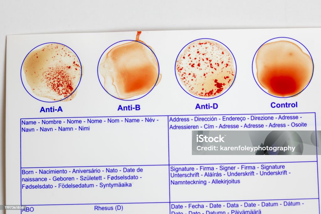 Blood Type Testing Card Home Blood Type Testing Card For Type A Stock Photo - Download Image ...