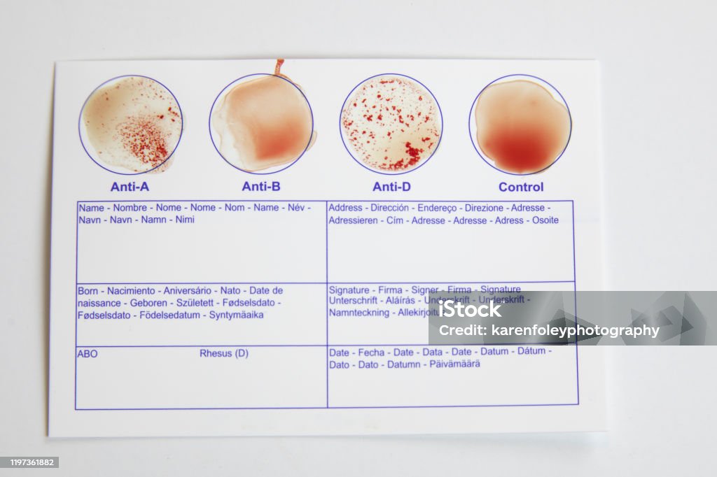 A Blood Sample Example Home Blood Type Testing For Type A Stock Photo - Download Image Now ...