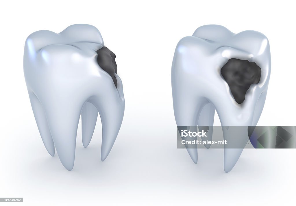 Teeth with caries  Color Image Stock Photo