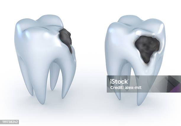 Teeth With Caries Stock Photo - Download Image Now - Color Image, Cut Out, Dental Health