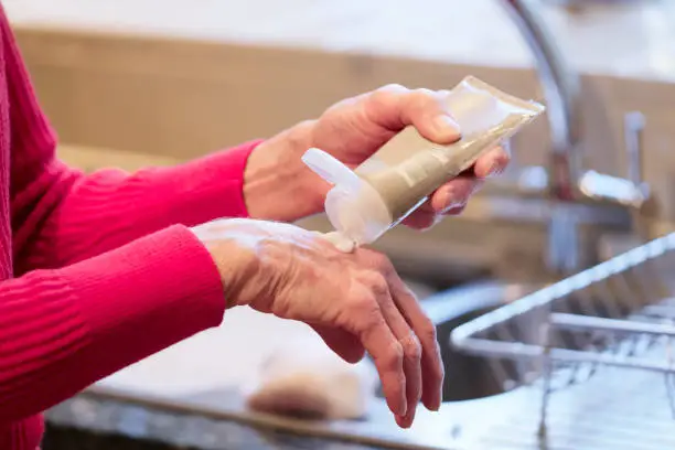 Elderly senior lady applying hand cream to old wrinkled cracked dry hands to moisturise for skin care UK
