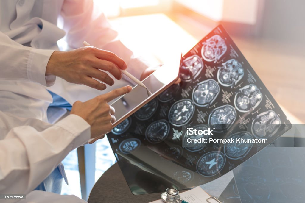MRI digital x-ray of brain with team radiologist doctor oncology working together in clinic hospital. Medical healthcare concept. Oncology Stock Photo
