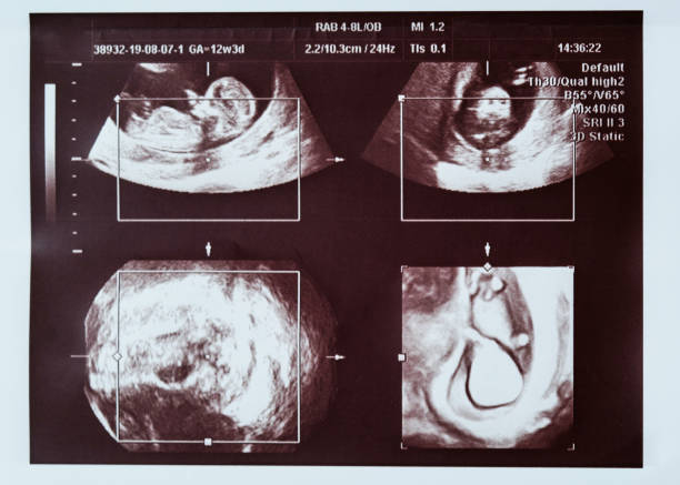 istock Ultrasound scan of a child. Collage, different angles. 1197512022