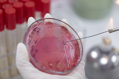 Placa de raya para el cultivo de bacterias o identificar la investigación de bacterias en la micrología de laboratorio. photo