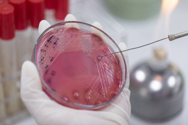 istock Streak plate for Bacteria culture or identify Bacteria research in labmicrology. 1197543813