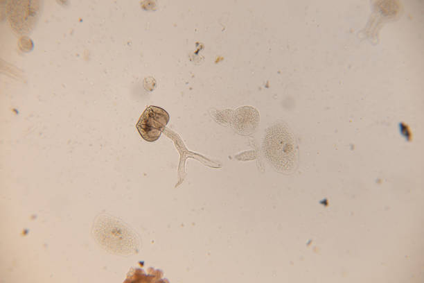 istock Study Movement and Specimens of Transversotrema patiallensis (parasite) under the microscopic in laboratory. 1197543833