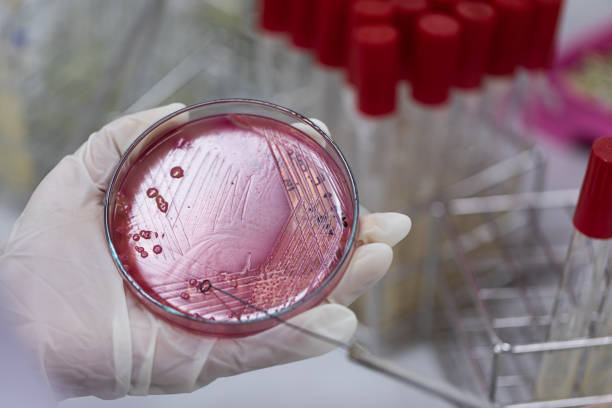istock Streak plate for Bacteria culture or identify Bacteria research in labmicrology. 1197543851