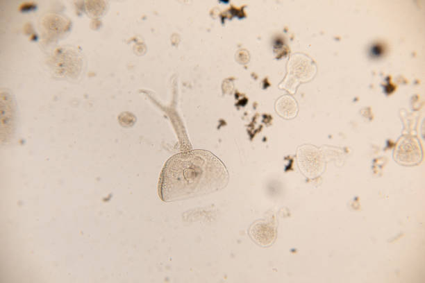 Study Movement and Specimens of Transversotrema patiallensis (parasite) under the microscopic in laboratory.
