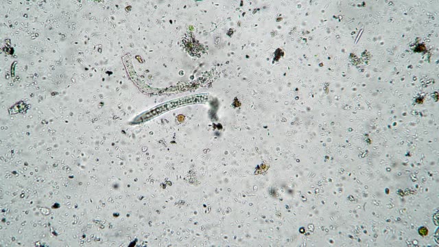 The nematode worm moves among numerous clusters of bacteria and microorganisms