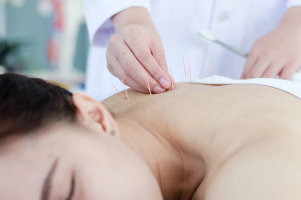 istock hand of doctor performing acupuncture therapy 1197783078