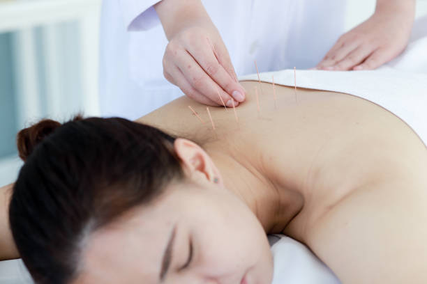 istock hand of doctor performing acupuncture therapy 1197783095