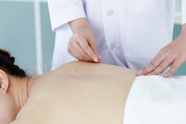 istock hand of doctor performing acupuncture therapy 1197783142