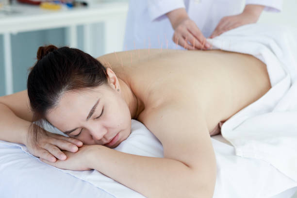 istock hand of doctor performing acupuncture therapy 1197783155