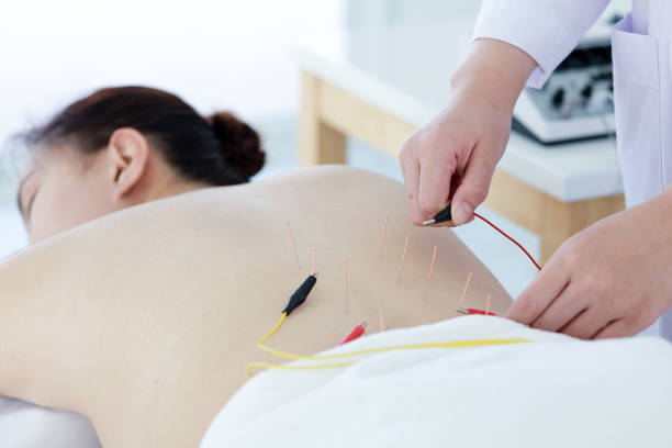 istock hand of doctor performing acupuncture therapy 1197783182