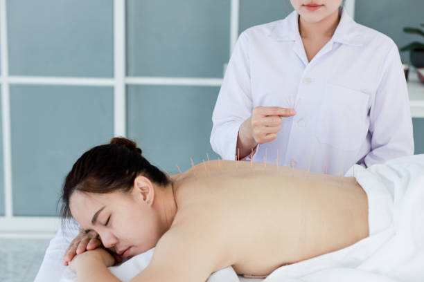istock hand of doctor performing acupuncture therapy 1197783252