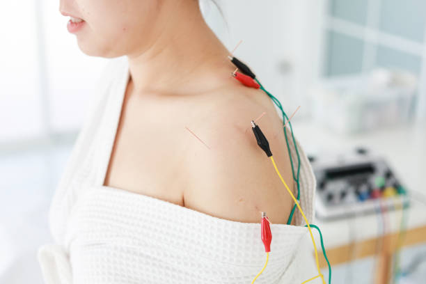 istock hand of doctor performing acupuncture therapy 1197783323