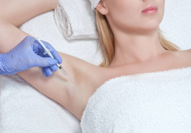 The doctor makes injections of botulinum toxin in the underarm area against hyperhidrosis. Treatment of problem skin cosmetology concept. The doctor makes injections of botulinum toxin in the underarm area against hyperhidrosis. Treatment of problem skin cosmetology concept. sweat gland stock pictures, royalty-free photos & images