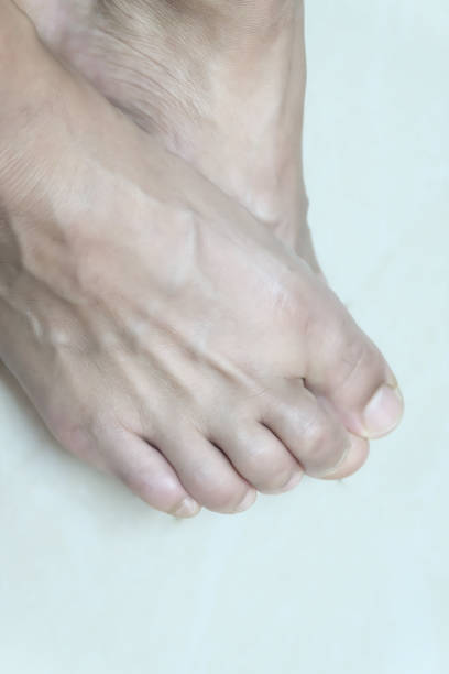 istock Close up foot male on floor. 1198014536