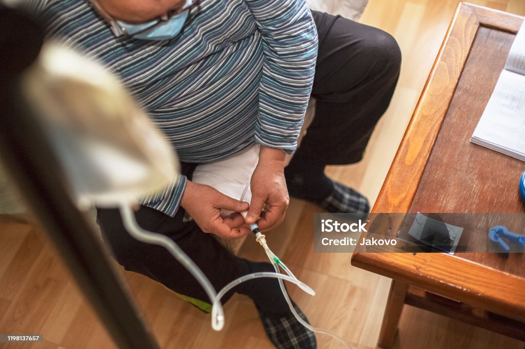 Senior man connecting peritoneal dialysis with catheter at home Peritoneal Dialysis Stock Photo