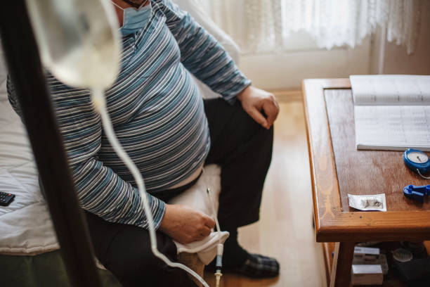 Senior man connecting peritoneal dialysis with catheter at home Senior man connecting peritoneal dialysis with catheter at home kidney failure photos stock pictures, royalty-free photos & images