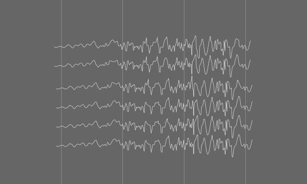 illustrazioni stock, clip art, cartoni animati e icone di tendenza di onde cerebrali epilettiche su sfondo nero - eeg