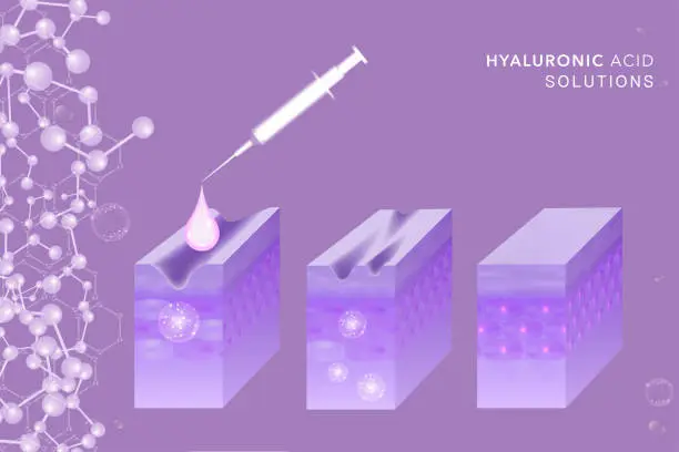 Vector illustration of Hyaluronic acid before and after skin solutions ad, purple collagen serum drop with cosmetic advertising background ready to use.
