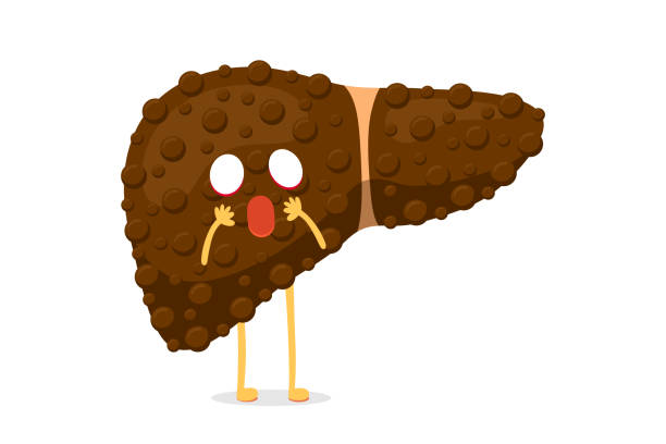 Fatty Liver Cartoon Illustrations, Royalty-Free Vector Graphics & Clip Art - iStock Fatty Liver Cartoon Illustrations, Royalty-Free Vector Graphics & Clip Art - iStock