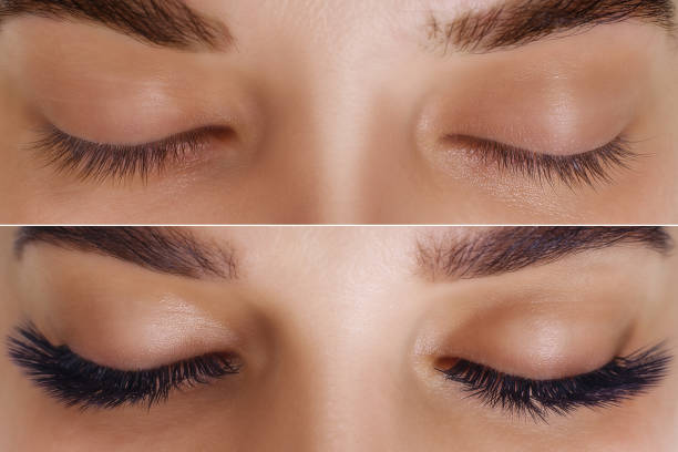 istock Eyelash Extension. Comparison of female eyes before and after 1198264300