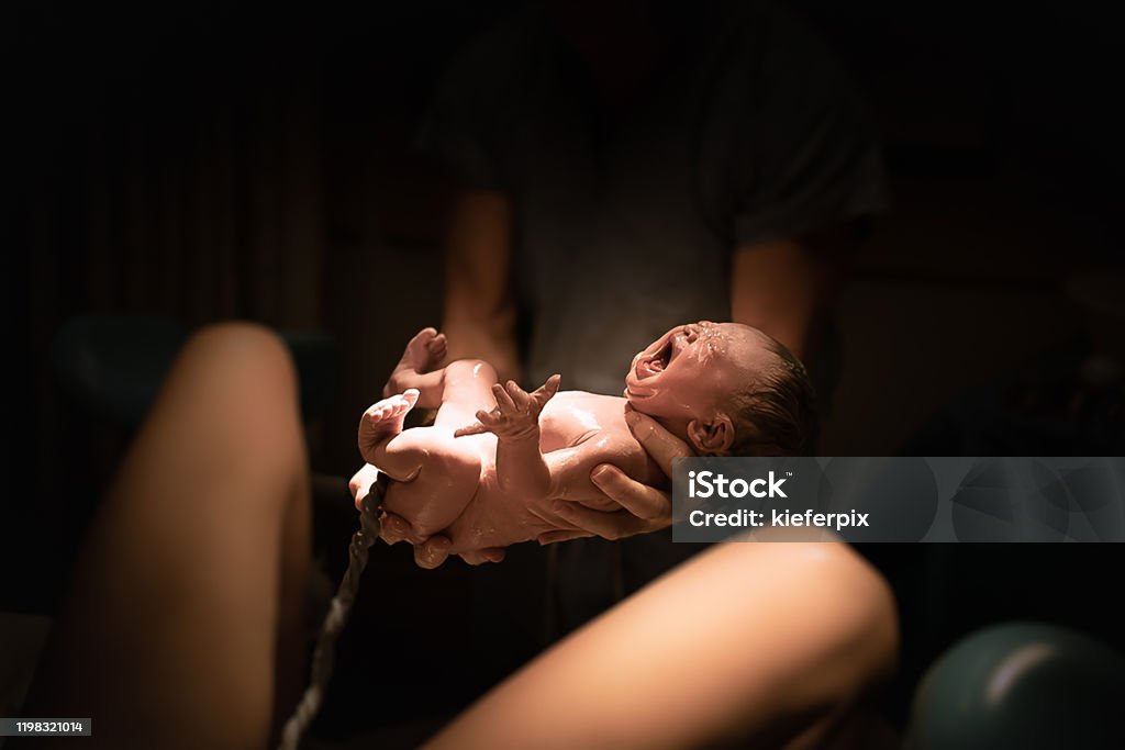 Baby delivery Labor in the hospital. Baby being born in vaginal delivery. Vaginal birth. Childbirth Stock Photo