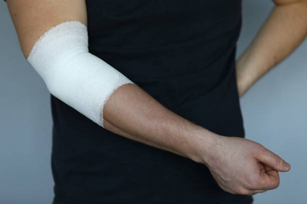 main mâle avec le bandage élastique serré sur le plan rapproché de coude - physical injury bandage wound cast photos et images de collection