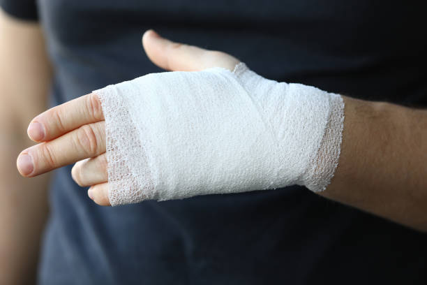main mâle avec le bandage élastique serré sur le plan rapproché de bras - physical injury bandage wound cast photos et images de collection