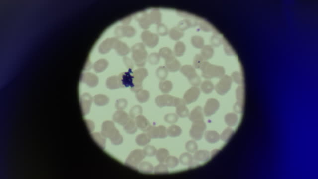 Biological cells seen through microscope