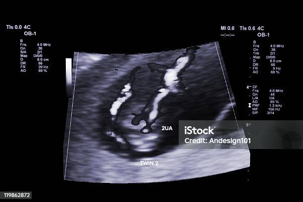 Twin Ultrasound Stock Photo - Download Image Now - Pregnant, Twin, Ultrasound