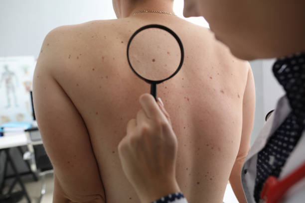istock Dermatology appointment at clinic 1198638509