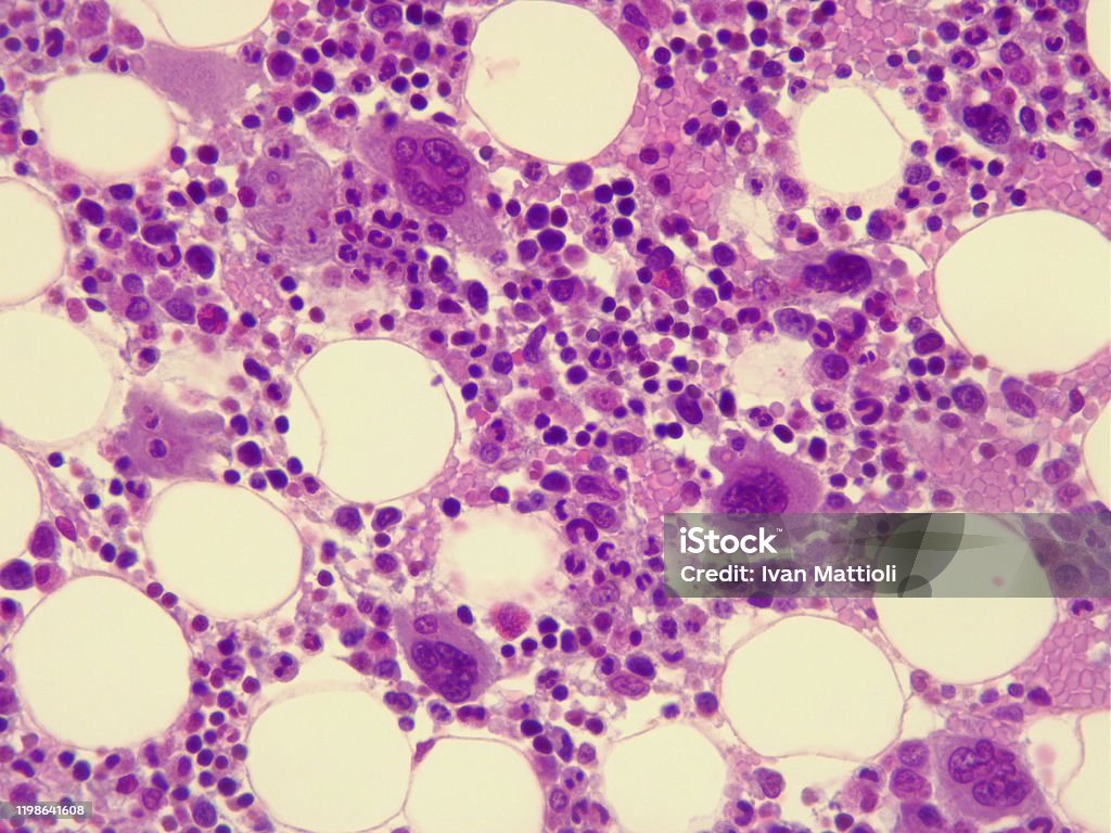 Human bone marrow under the microscope. Human bone marrow under the microscope. 400x magnification Bone Marrow Tissue Stock Photo