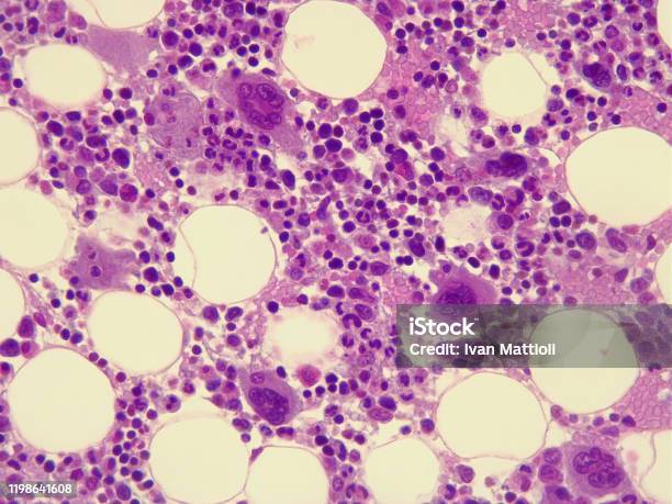 Human Bone Marrow Under The Microscope Stock Photo - Download Image Now - Bone Marrow Tissue, Bone Marrow, Biological Cell