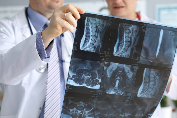 istock Doctor with co-worker speaking about radiogram 1198643378