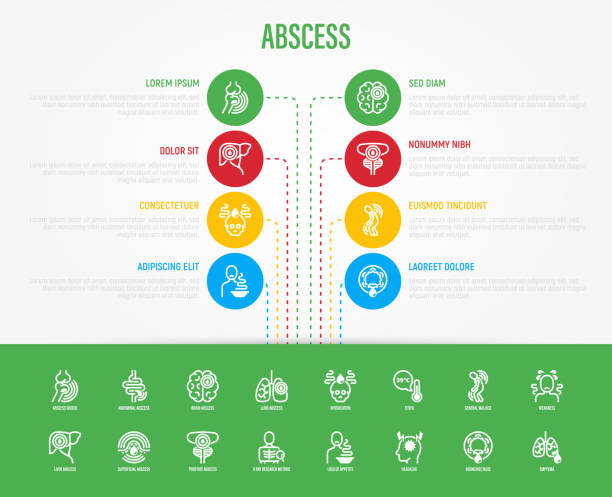 ilustrações de stock, clip art, desenhos animados e ícones de abscess infographics with thin line icons. joint, abdominal, brain, intestine, lung, liver, superficial abscess, x-ray research method, intoxication, empyema. vector illustration, web page template - intoxication