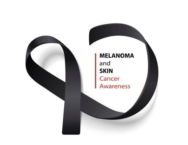 Realistic black ribbon - symbol of melanoma and skin cancer awareness month. Realistic black ribbon - symbol of melanoma and skin cancer awareness month. Dark colored satin band loop isolated on white background with text - vector illustration. melanoma stock illustrations